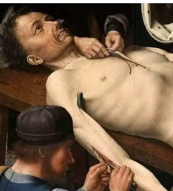A 16th-century painting depicts the flaying of a corrupt judge.