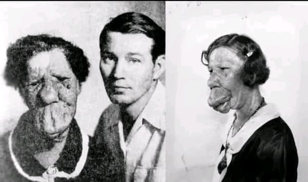 The Inspiring Story of Grace McDaniels, the "Mule-Faced Woman"